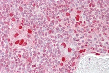 RAB23 Antibody