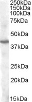 PENK Antibody
