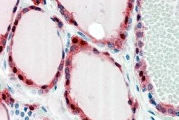MRP8 Antibody