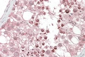 IFNAR2 Antibody