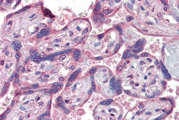 PLA2G16 Antibody