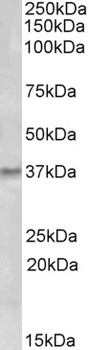 FZD2 Antibody