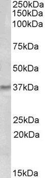 Frizzled 2 Antibody