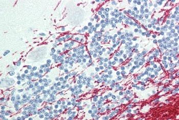 Frizzled 2 Antibody