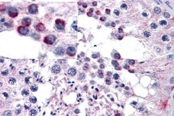 ATG16L1 Antibody