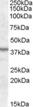 ARSD Antibody