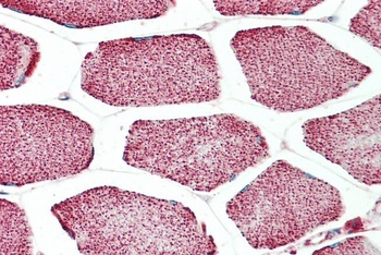 Apolipoprotein F Antibody
