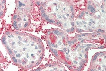 HSPA13/STCH Antibody