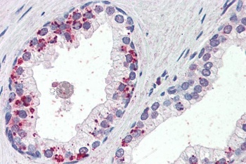 Annexin A1 Antibody
