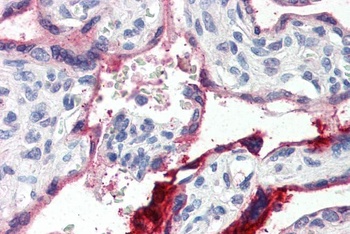 Annexin A1 Antibody