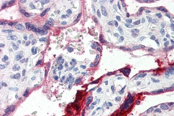 ANXA1 Antibody