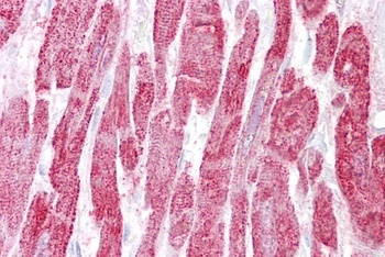 EPM2A Antibody