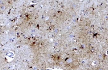 GAD1 Antibody