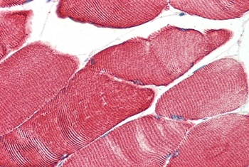 DES Antibody