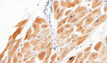 DES Antibody