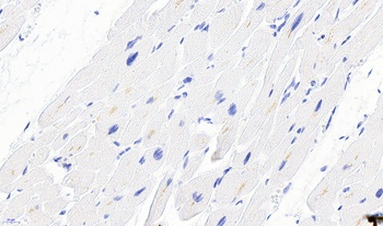 DES Antibody