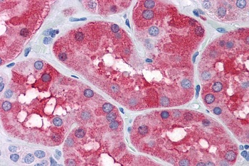 FTL Antibody