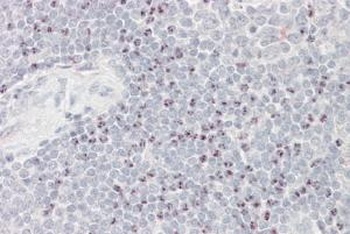 FTL Antibody
