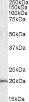 FTL Antibody