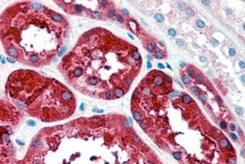 FTH1 Antibody