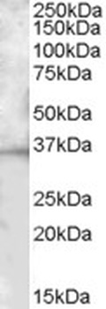 ALOX15 Antibody