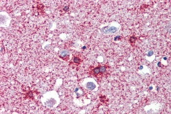 SEPT2 Antibody