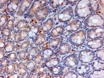MTHFD1 Antibody