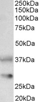 Keratin 13 Antibody