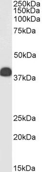 Keratin 13 Antibody