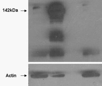 COL4A3BP Antibody