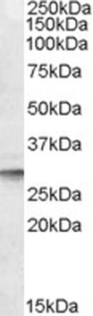 CLTA Antibody
