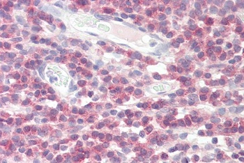 CLTA Antibody