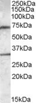 TACSTD2 Antibody