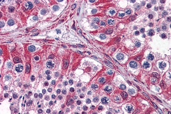 TACSTD2 Antibody