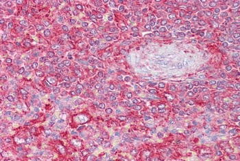 ERN1 Antibody