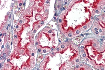 APOBEC3G Antibody