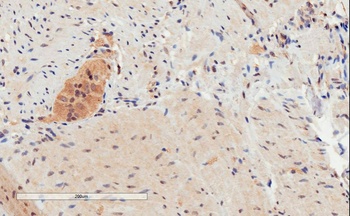 SAR1 Antibody