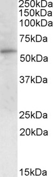 Stra6 Antibody