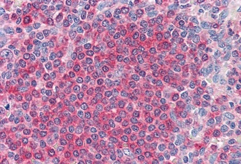 RARRES3 Antibody