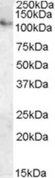 PPP2R3A Antibody