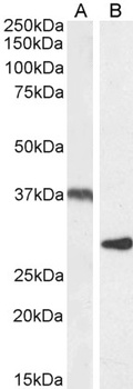 Neuroligin 2 Antibody