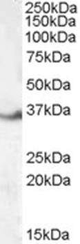 KCNJ11 Antibody