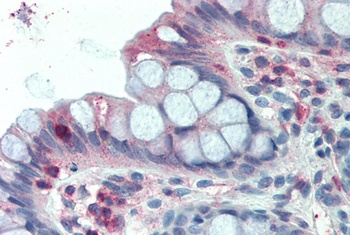 KCNJ11 Antibody