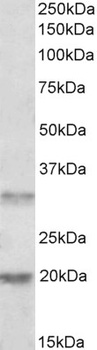 IGF2BP2 Antibody