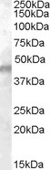 IGF2BP2 Antibody