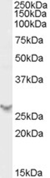 Carabin Antibody