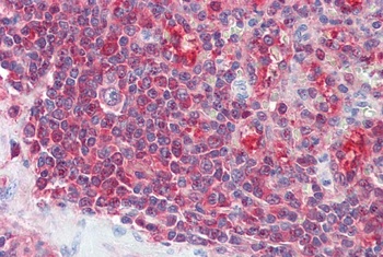 Carabin Antibody