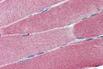CADM4 Antibody