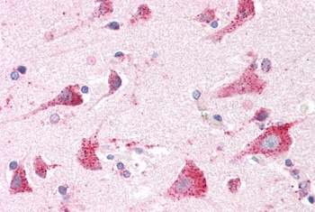 CADM4 Antibody