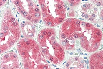 BDH2 Antibody